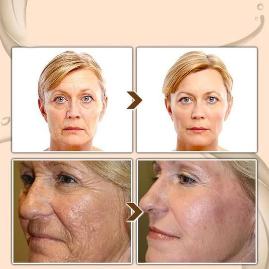 🔥 Calcium Multi Balm | Anti-aging, Sagging, Wrinkles 💫